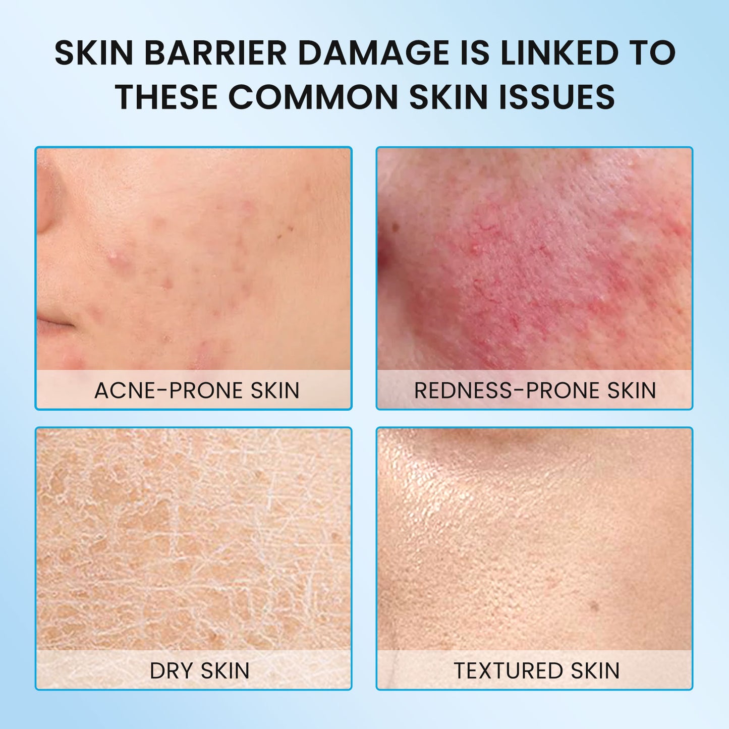 5X Ceramides Barrier Moisturizer (all skin types especially for sensitive skin) - repairs skin in 7 days