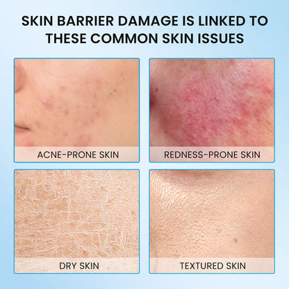 5X Ceramides Barrier Moisturizer (all skin types especially for sensitive skin) - repairs skin in 7 days