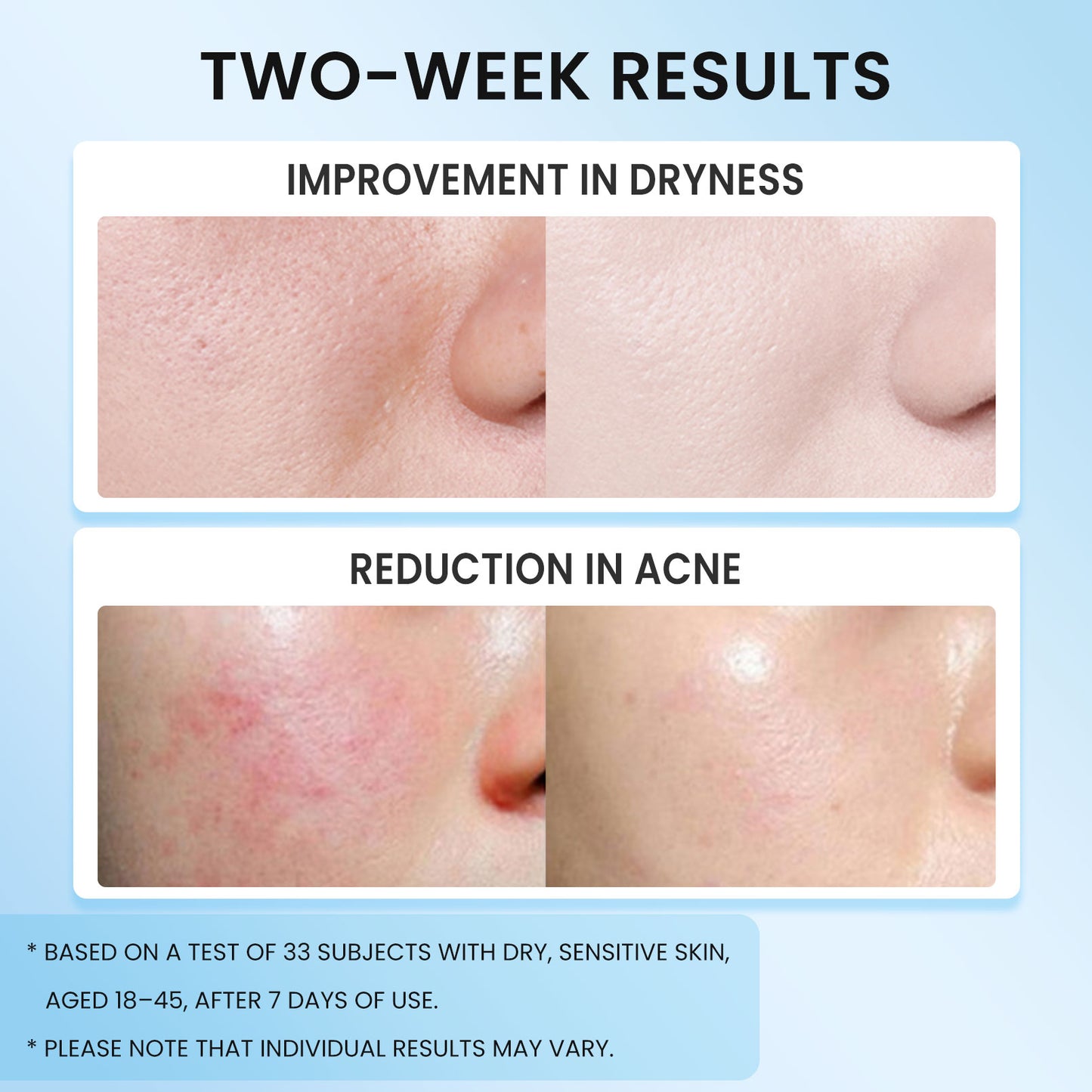 5X Ceramides Barrier Moisturizer (all skin types especially for sensitive skin) - repairs skin in 7 days